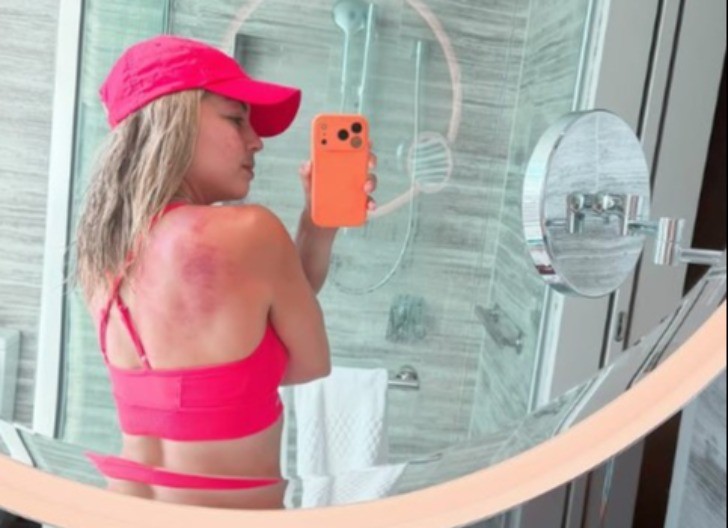 KARAMBA Renata osetila vrelinu australijskog sunca, a onda i moć Srpkinje